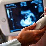 Pregnancy Clinic in Vizag | Complete Pregnancy Care
